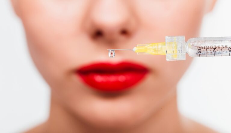 Migrarea acidului hialuronic – ce este și cum o previi cu un medic cu experiență